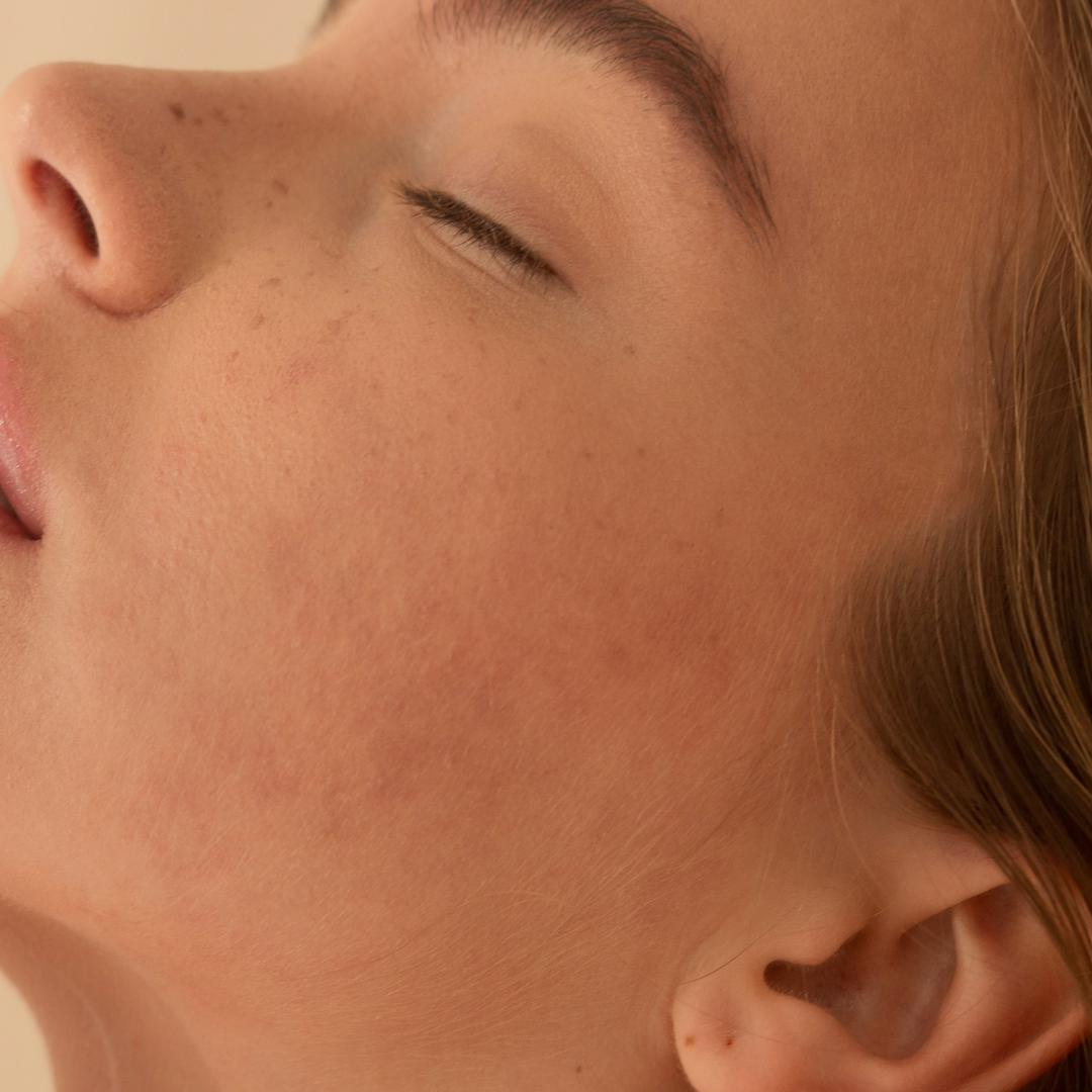 Hidratación y Prevención